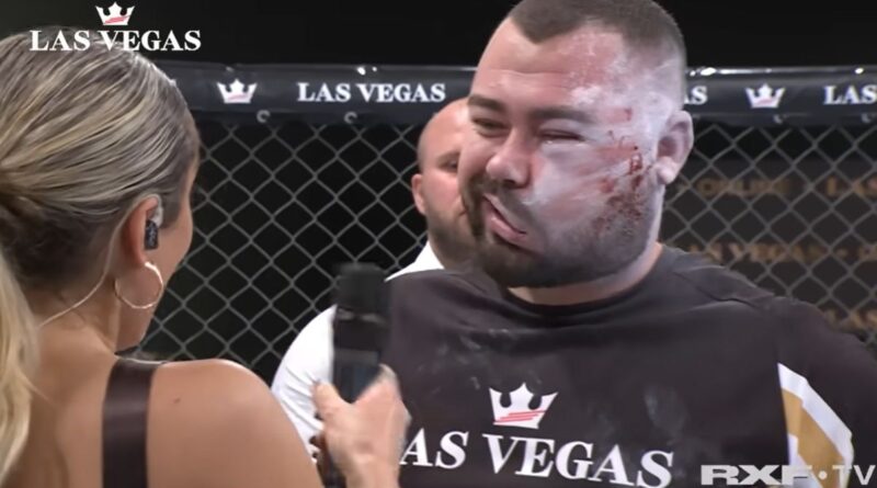 Concurs de dat palme Ce au spus doctorii când l-au văzut pe bărbatul care s-a lăsat desfigurat